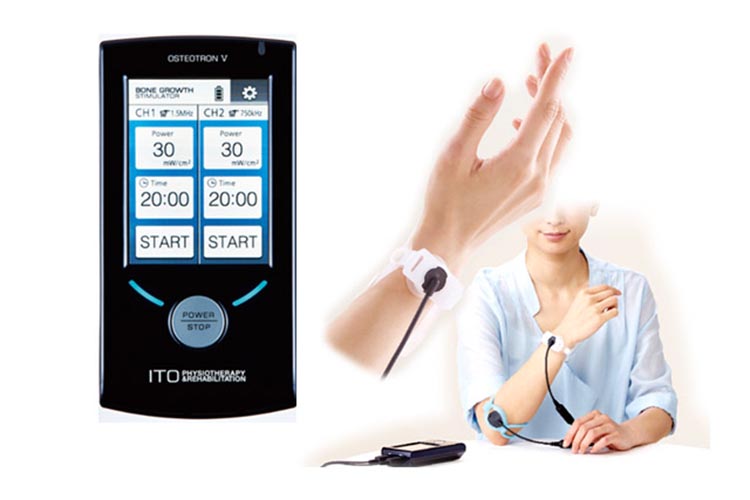 超音波骨折治療器（オステオトロンV)