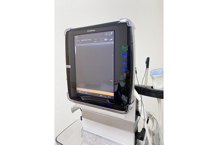 超音波診断装置